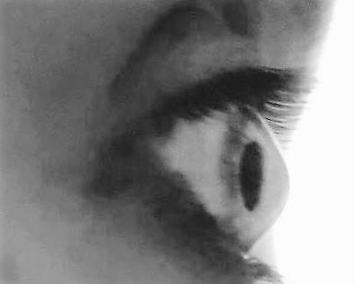 KERATOCONUS FOUNDATION OF SA INT